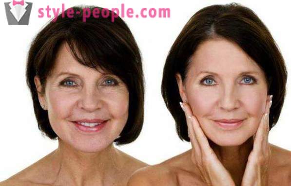 Tai įmanoma nuvalyti vandenilio peroksido veidą? Vandenilio peroksidas veido raukšlės, spuogai ir amžiaus dėmių