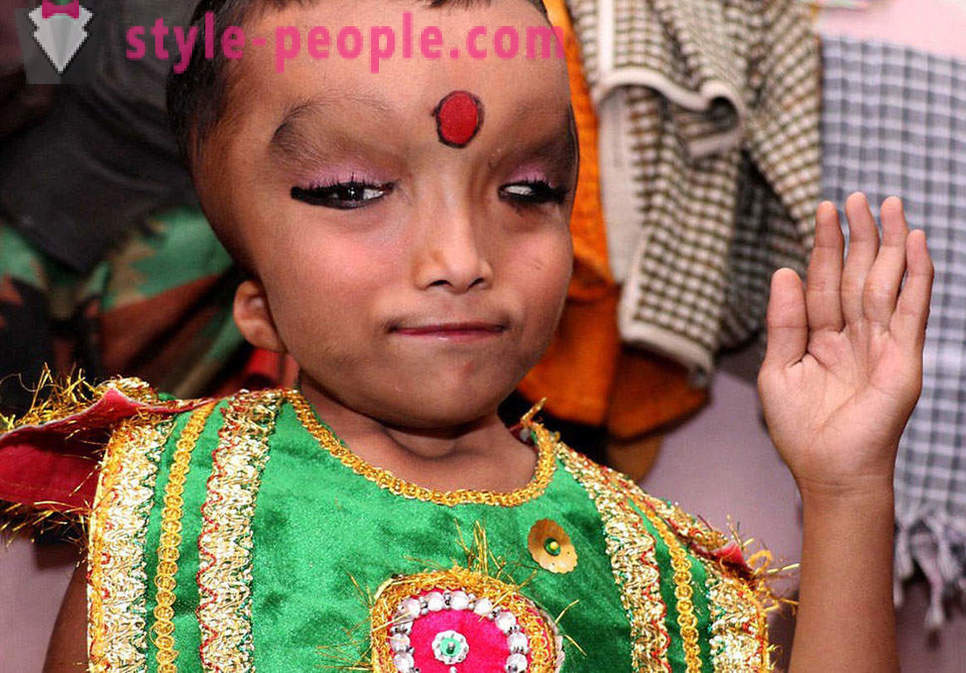 Indijos kaimas yra garbinamas berniukas su iškreipto galvos kaip Dievo Ganesha